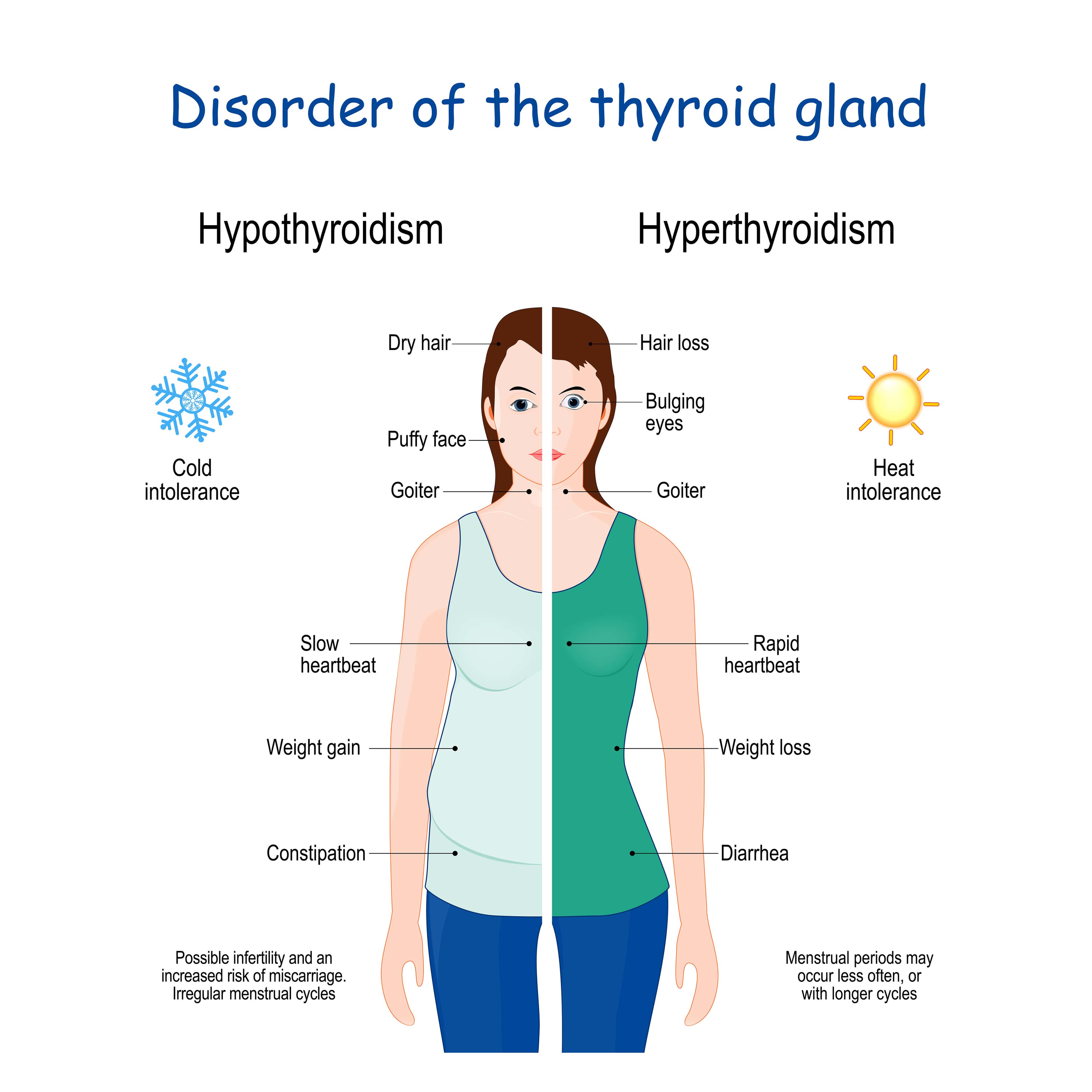 Autoimmune Problems That Can Lead To Hypothyroidism Or Hyperthyroidism 