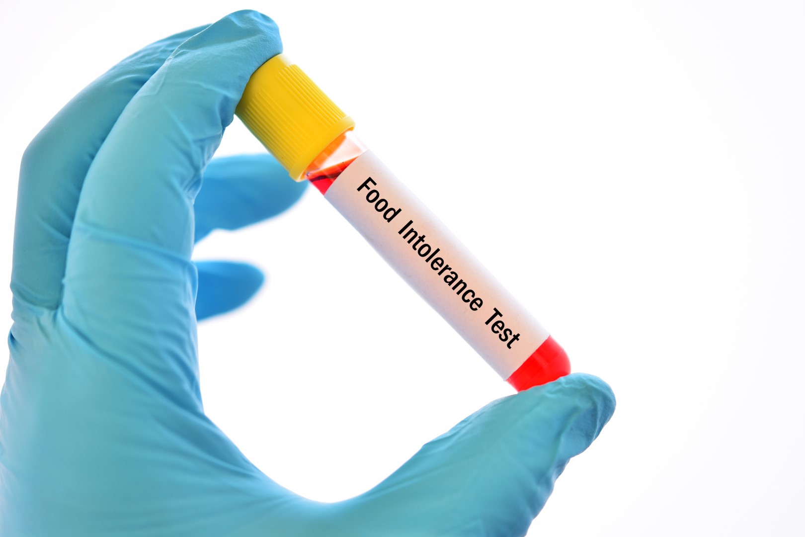 food sensitivity testing blood tube