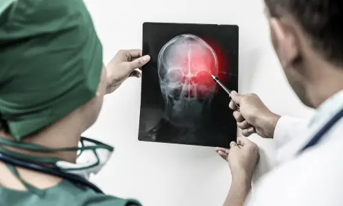 Blue Ridge chiropractors looking at concussion x-ray
